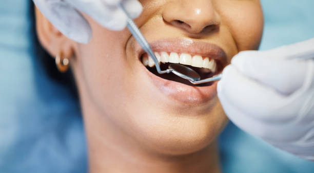 Best Emergency Dental Care for Broken or Chipped Teeth in Temple City, CA