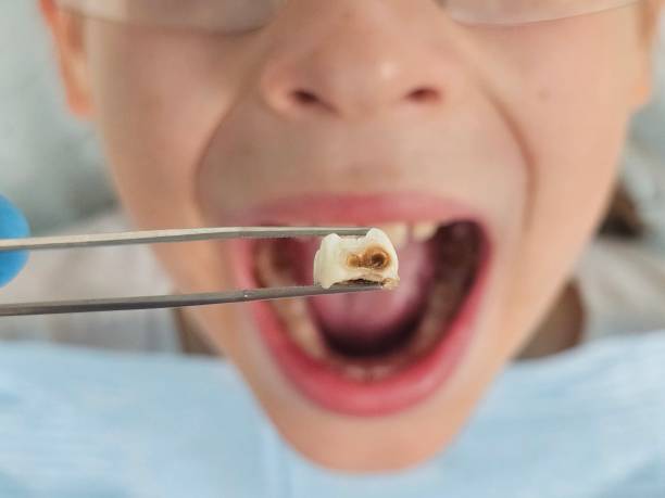 Best Emergency Gum Treatment in Temple City, CA